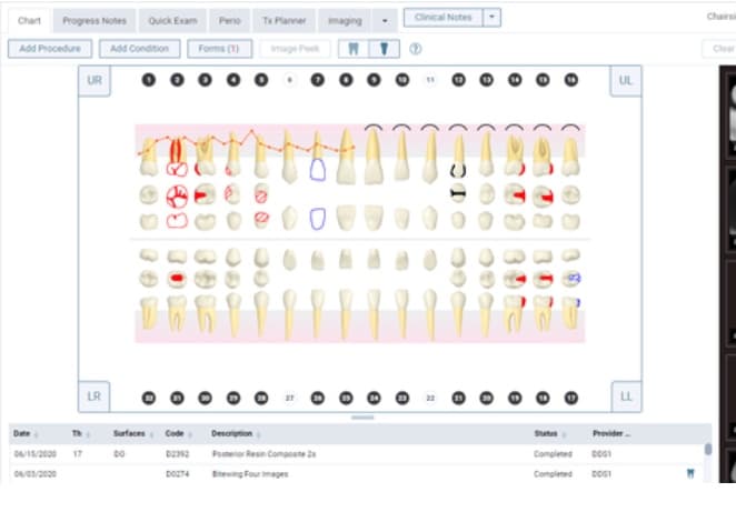 Dentrix Ascend